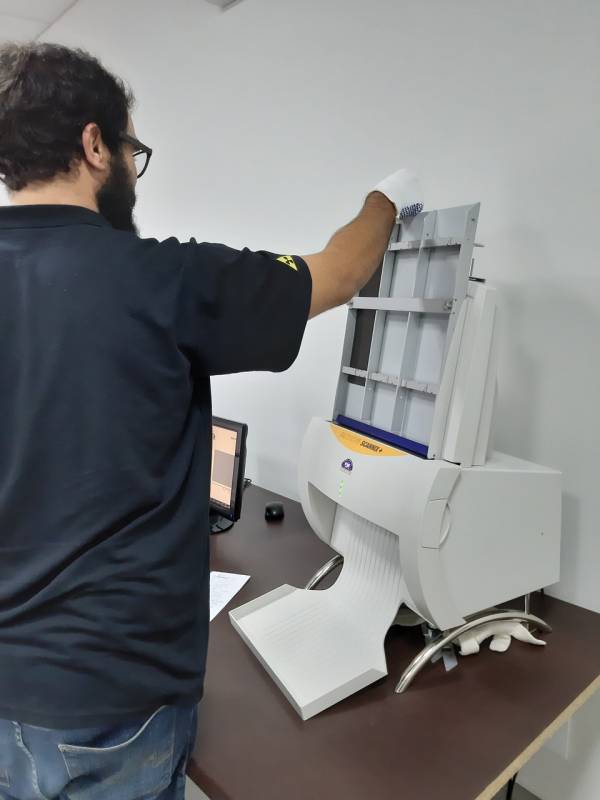 Onde Encontro Digitalização de Filmes Radiográficos e Ecrans Guarulhos - Digitalização de Filme Radiográfico Velado