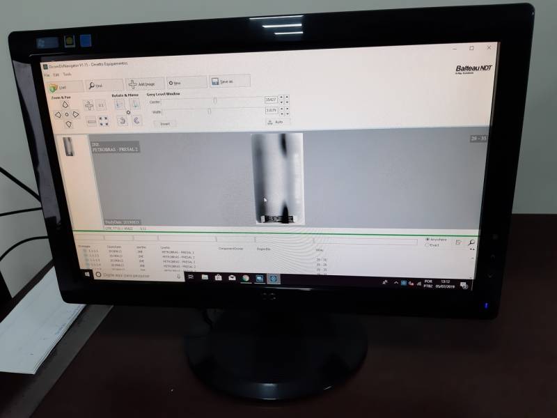 Onde Encontro Digitalização de Filmes Radiográficos Odontológicos Dirce Reis - Digitalização de Filmes Radiográficos Convencionais