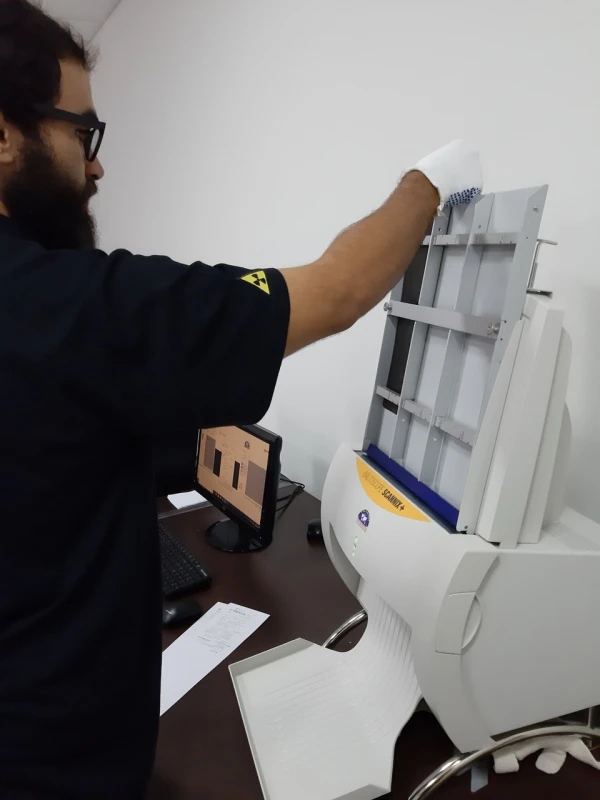 digitalização de filme radiográfico raio x