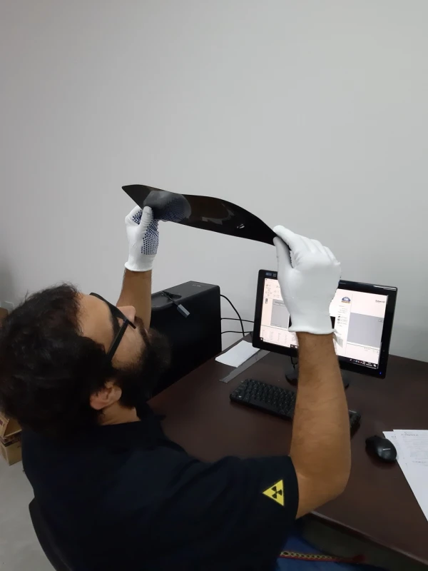 digitalização e revelação de filmes radiográficos